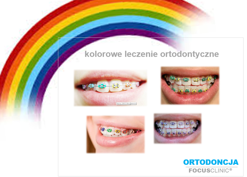 Jak wygląda leczenie ortodontyczne?