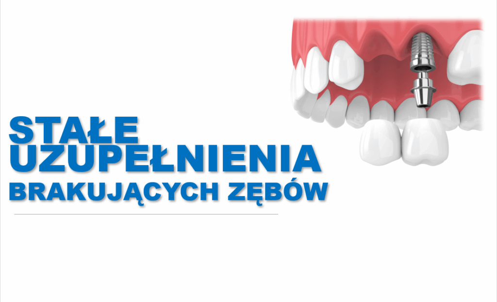 Jak uzupełnić brak kilku zębów?