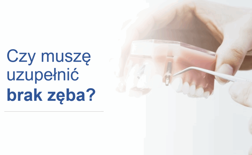 czy muszę uzupełnić brak zęba?