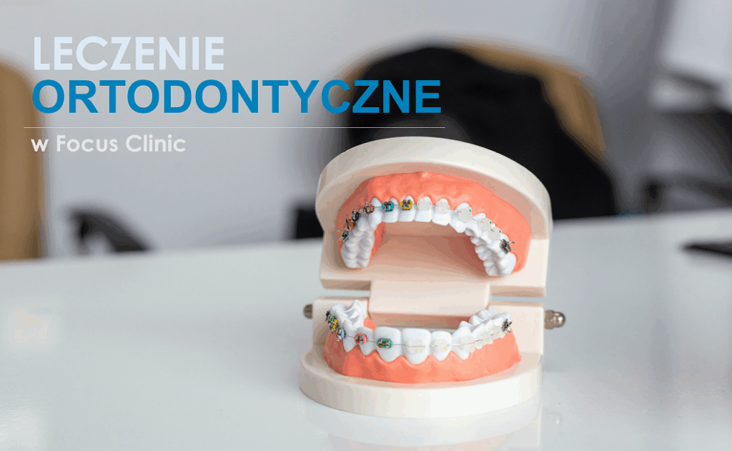 leczenie ortodontyczne mińsk mazowiecki